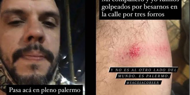 Ataque homofóbico en Palermo: lo golpearon con un palo por besar a su novio