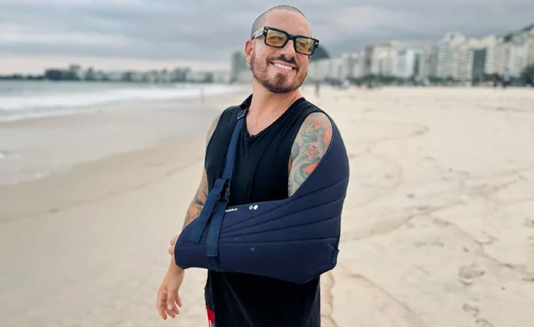  Fede Bal vuelve a viajar tras el accidente en Brasil: cuándo recuperará la movilidad de su brazo y su mano
