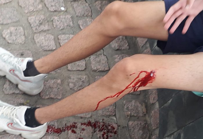 23263 herido morteros