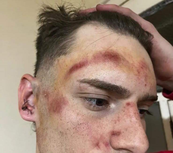 Grave episodio de violencia en un partido de la Liga Regional en Pozo del Molle